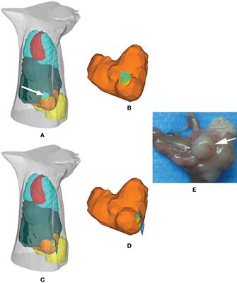 Harnessing the Power of Hybrid Light Propagation Model for Three-Dimensional Optical Imaging in Cancer Detection